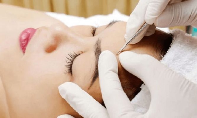 Top 5 địa chỉ nặn mụn uy tín nhất tại TPHCM