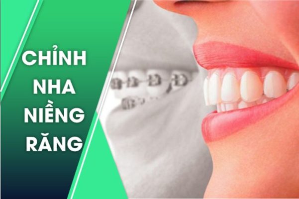 Niềng răng ở đâu tốt nhất TPHCM? Xem top địa chỉ uy tín