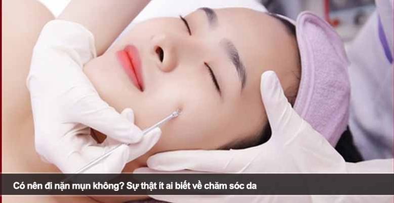 Có nên đi nặn mụn không? Sự thật ít ai biết về chăm sóc da