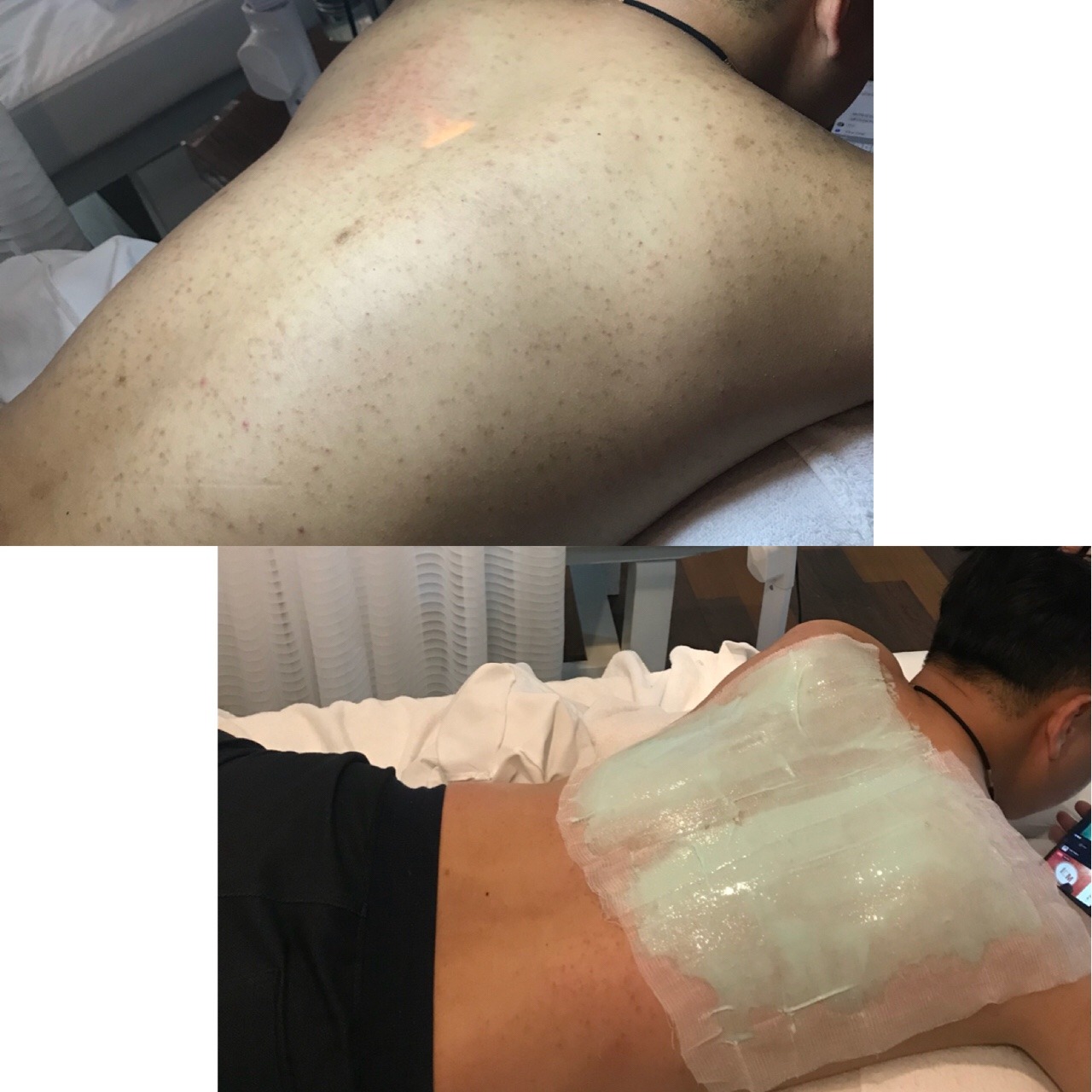 Top 10 Spa trị mụn lưng uy tín & hiệu quả tại TPHCM