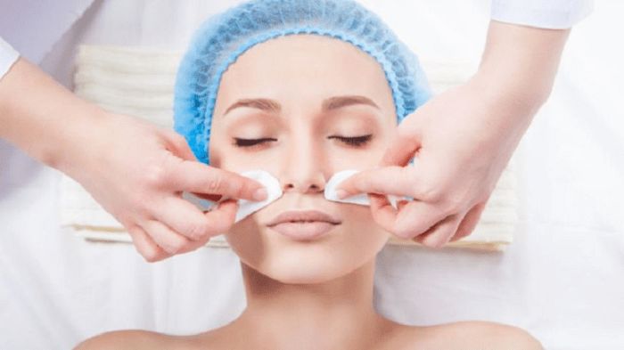 Top 5 địa chỉ nặn mụn uy tín nhất tại TPHCM
