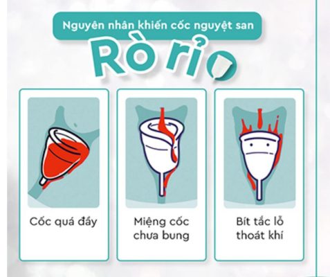 Những tình huống thường gặp khi sử dụng cốc nguyệt san
