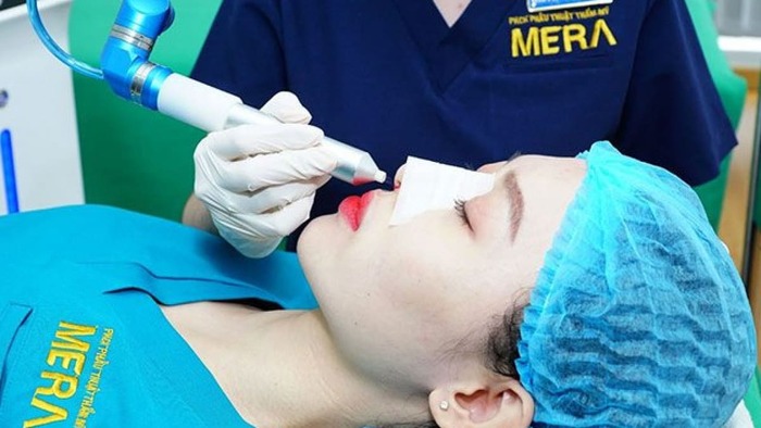 Top 13 địa chỉ nâng mũi bọc sụn uy tín và chuyên nghiệp được phái đẹp săn đón nhất 2022