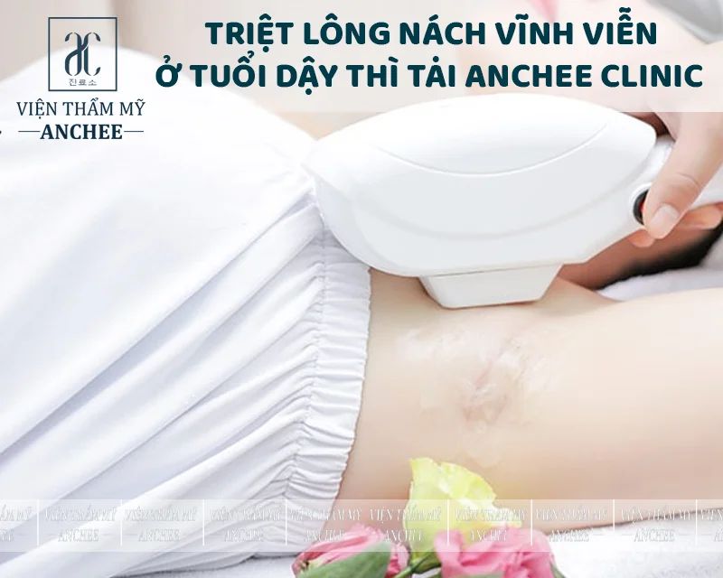 Triệt lông nách có ảnh hưởng gì không? Những cách triệt lông nách đơn giản tại nhà