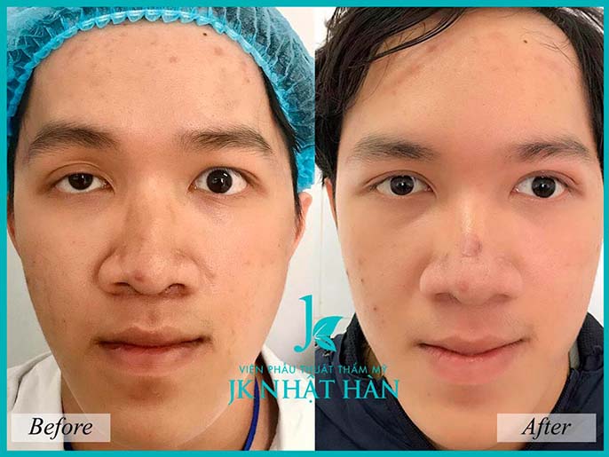 Địa chỉ phẫu thuật thẩm mỹ mắt to mắt nhỏ uy tín tại Sài Gòn