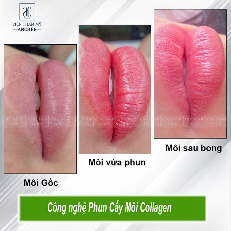 Địa chỉ phun môi màu đỏ cam đẹp - Bống Spa & Clinic