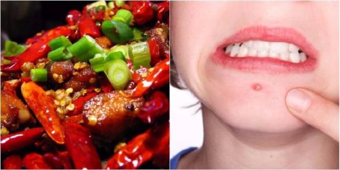 Ăn cay có tốt không? Tác hại của việc ăn cay mà bạn nên biết!