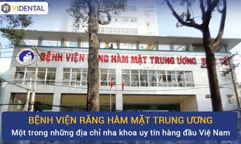 Top 5 địa chỉ niềng răng uy tín ở Hà Nội mà bạn nên biết