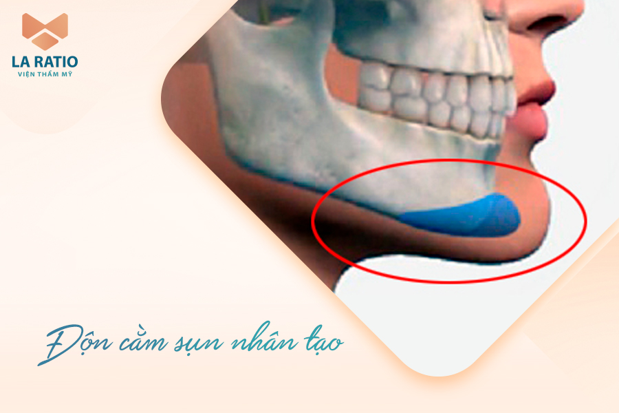 Top 3 cách cải thiện cằm ngắn hiệu quả