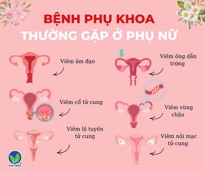 Viên đặt phụ khoa thảo dược VIETMEC có gì mà mọi chị em đều yêu thích?