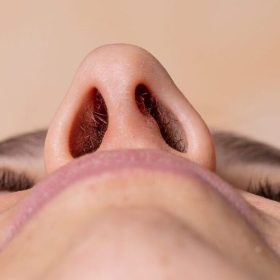Mũi bị lệch bẩm sinh có thể sửa được không, sửa bằng cách nào?