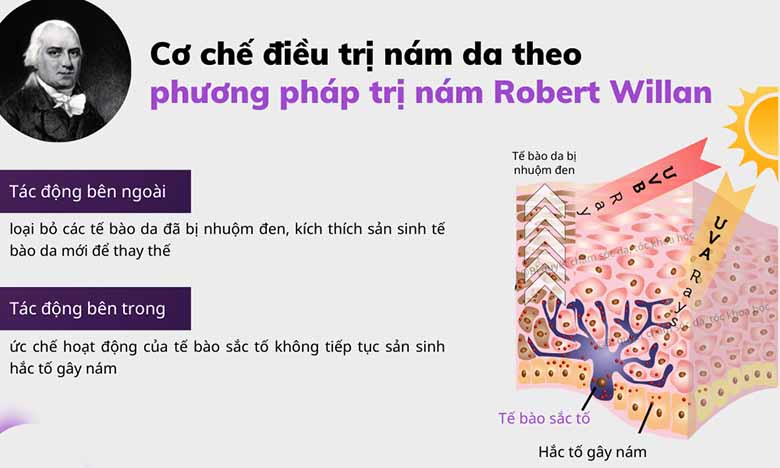 Kem trị nám Mélanosome - thành phần không thể thiếu theo cách trị nám Robert Willan