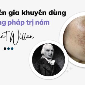 Chuyên gia da liễu khuyên dùng phương pháp trị nám Robert Willan