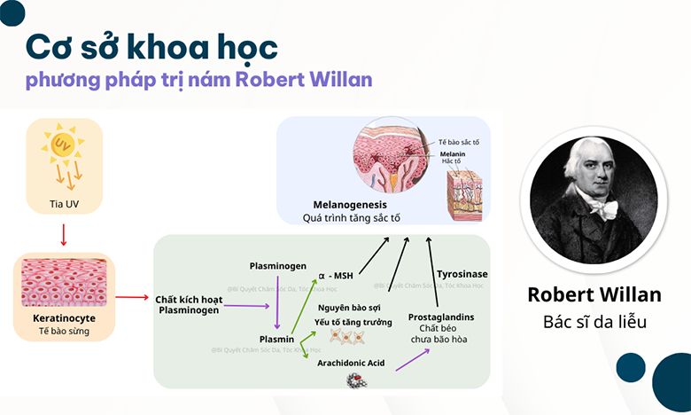Chuyên gia da liễu khuyên dùng phương pháp trị nám Robert Willan