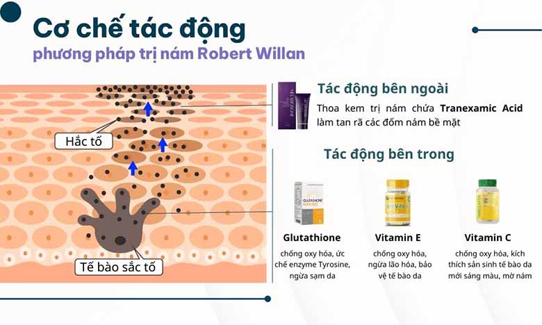 Chuyên gia da liễu khuyên dùng phương pháp trị nám Robert Willan
