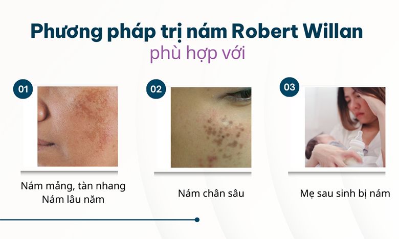 Chuyên gia da liễu khuyên dùng phương pháp trị nám Robert Willan