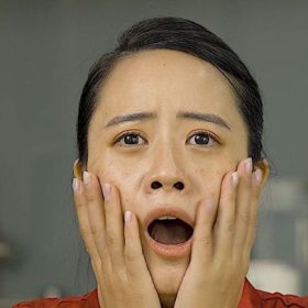 Trị nám sau sinh tại Mega Gangnam