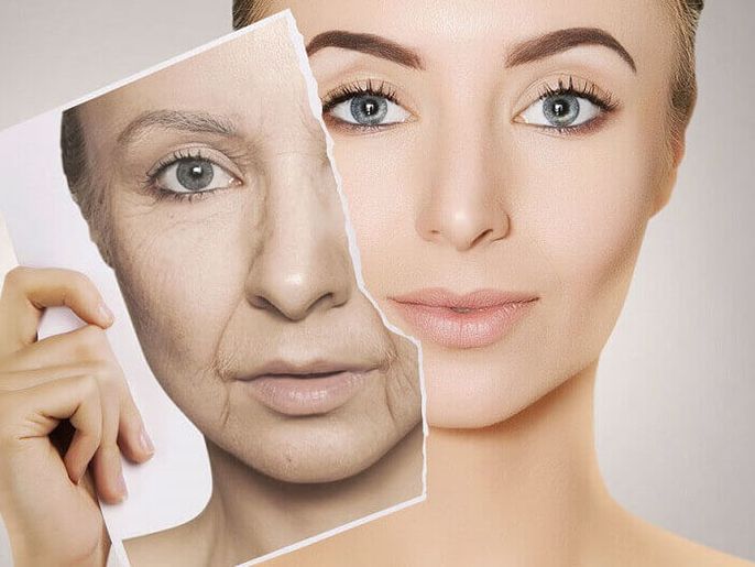 Các phương pháp căng da mặt được lựa chọn hiện nay