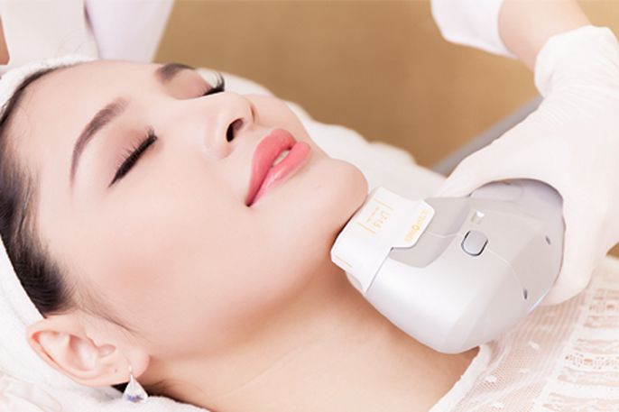 Các phương pháp căng da mặt được lựa chọn hiện nay