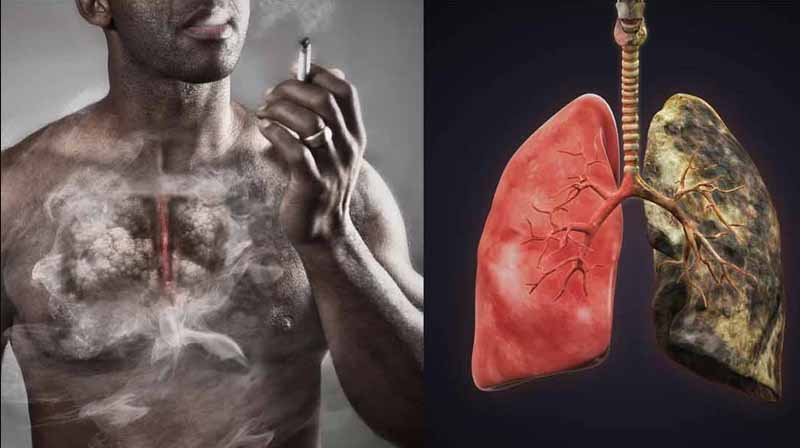 Những nguyên nhân gây bệnh ung thư phổi thường gặp nhất